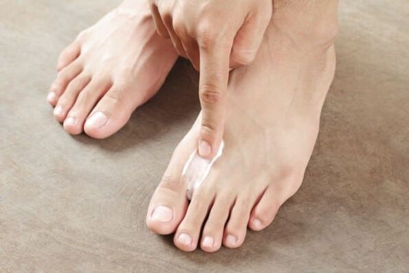 εφαρμογή αλοιφής από τον μύκητα του δέρματος στα πόδια